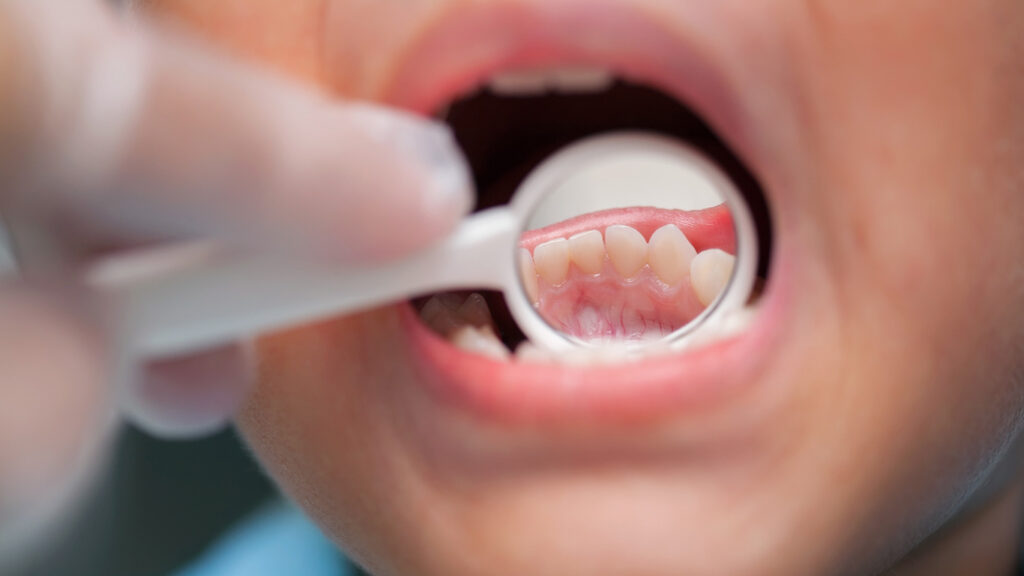 dental exam