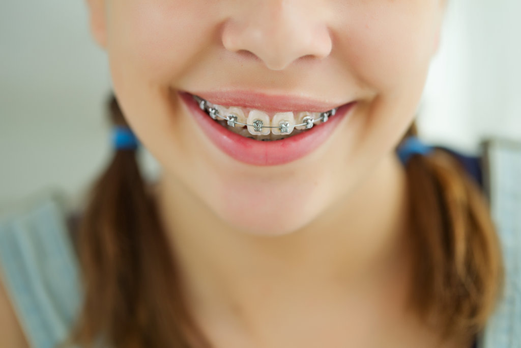 Girl with braces