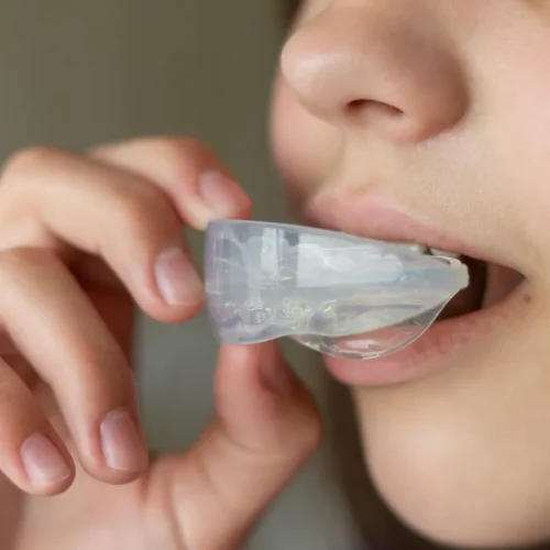 Orthodontic treatment of crooked teeth or malocclusion in a child with a silicone mouth guard or aligners. A teenager holds a mouth guard to his mouth. Close-up.